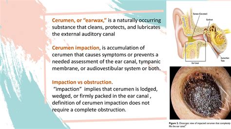 cerumen impaction tests diagnosis|excessive cerumen vs impacted.